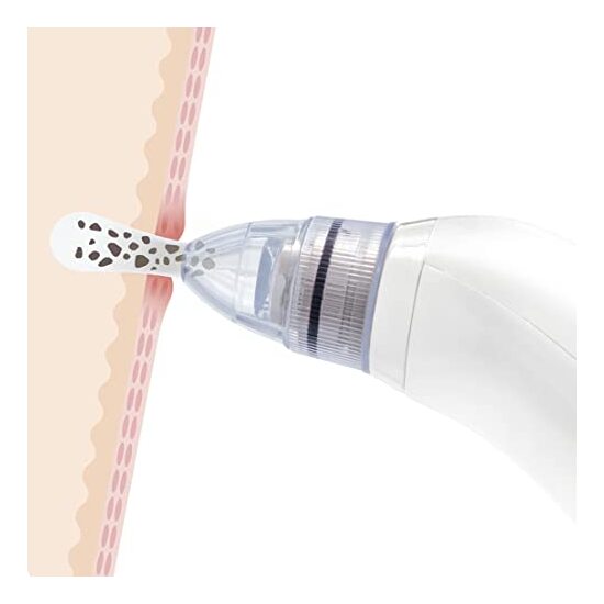 LIMPIADOR FACIAL ELÉCTRICO DE PUNTOS NEGROS PORE·OFF INNOVAGOODS image 1
