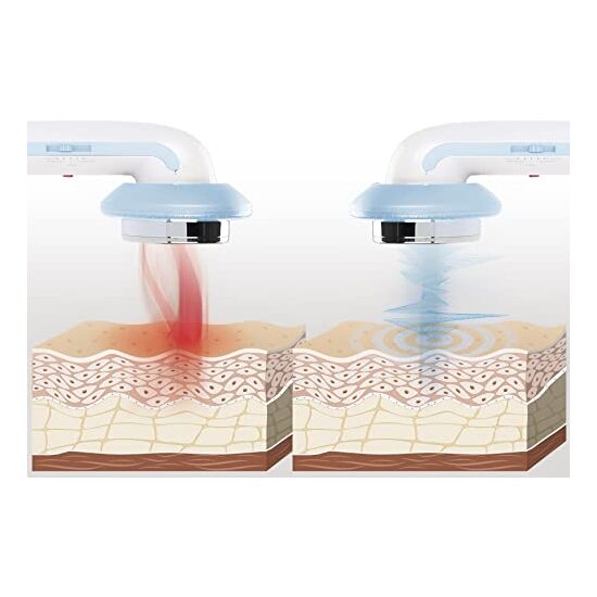 MASAJEADOR ANTICELULÍTICO DE CAVITACIÓN ULTRASÓNICA CON INFRARROJOS Y ELECTROESTIMULACIÓN 3 EN 1 CELLYMAX INNOVAGOODS image 5