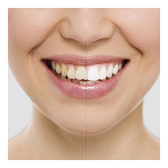 24 TIRAS BLANQUEADORAS DENTALES WRIPES INNOVA image 4